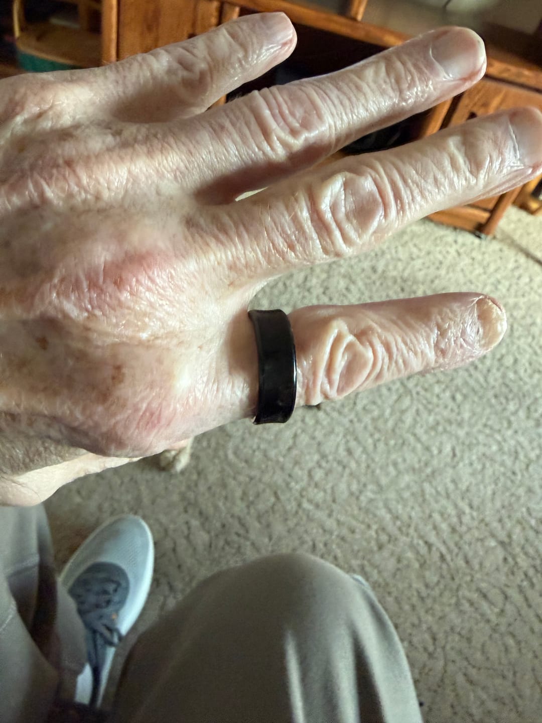 Customer photo review of Pulserive Smart Ring, Sleep Tracker, Activity & Fitness Tracker, Blood Pressure& Oxygen Tracker