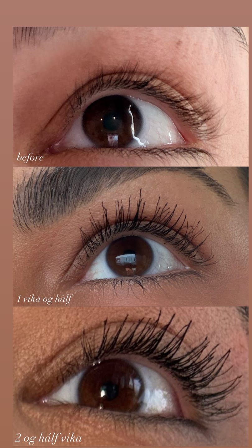 Customer photo review of Lash Serum | INTENSE