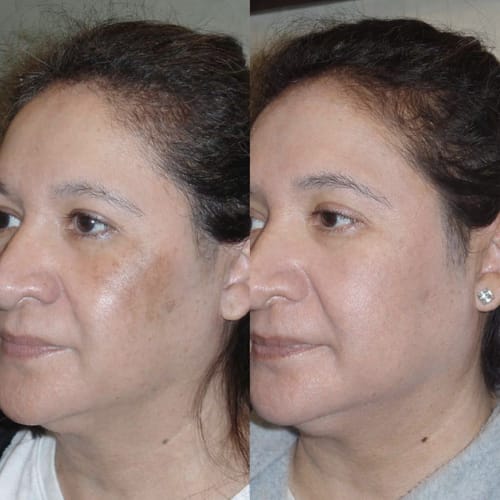 Customer photo review of Labbok Peptides Skin Lightening Combo Box