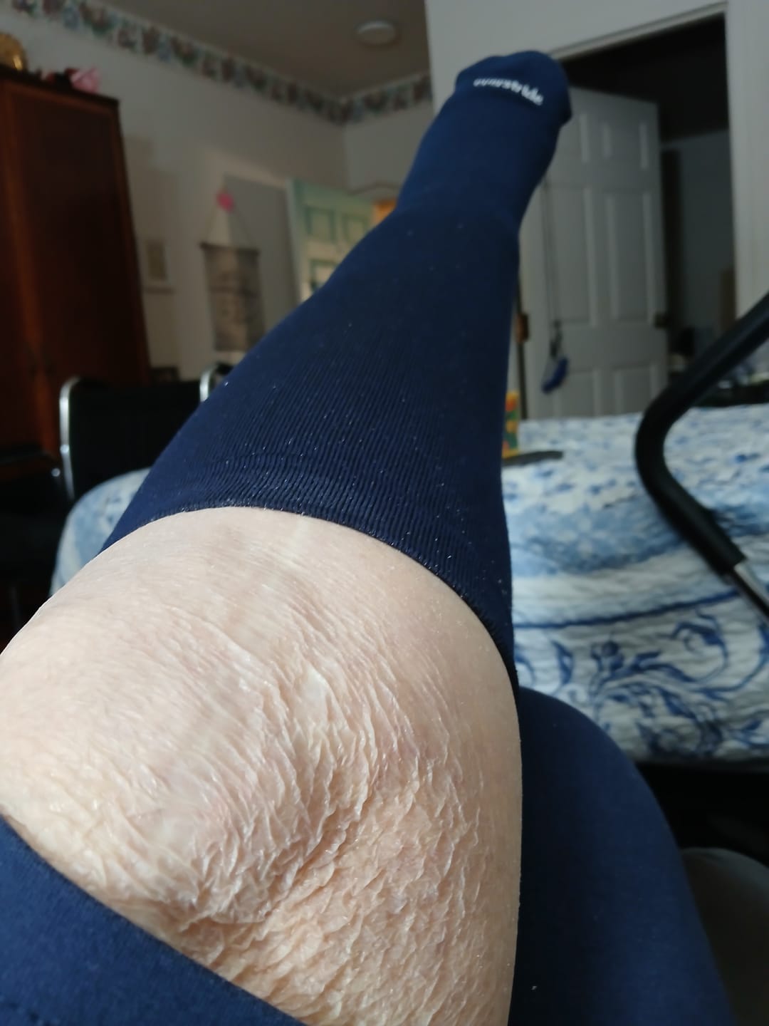 Customer photo review of Everstride™ Bamboo Compression Socks