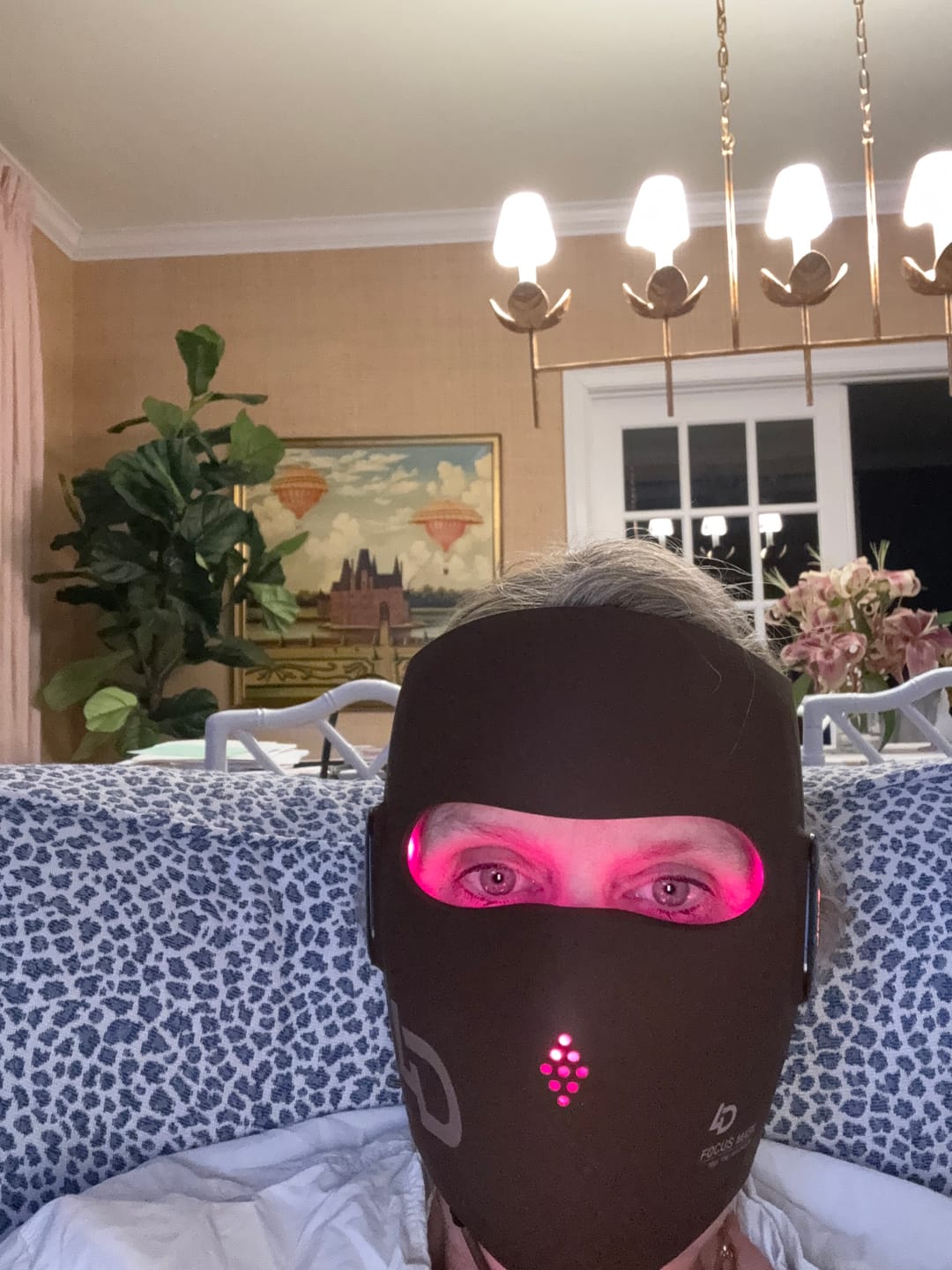 Customer photo review of JOVS 4D Laser Anti-Aging Therapy Mask
