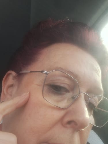 Customer photo review of Sérum de Vitamina C Estable para Manchas, Luminosidad y Firmeza ILEGAL