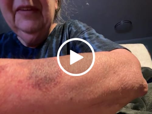 Customer video review of Besque® Magic Body Oil XL - 200ml