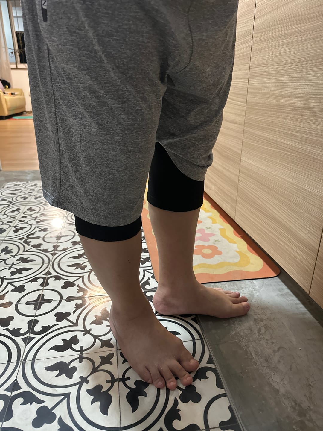 Customer photo review of Recovry™ V2 Kneesleeve