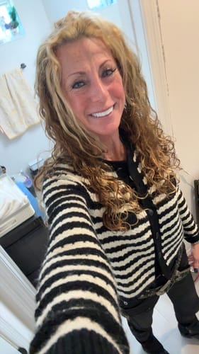 Customer photo review of Hyaluronic Serum Sealer
