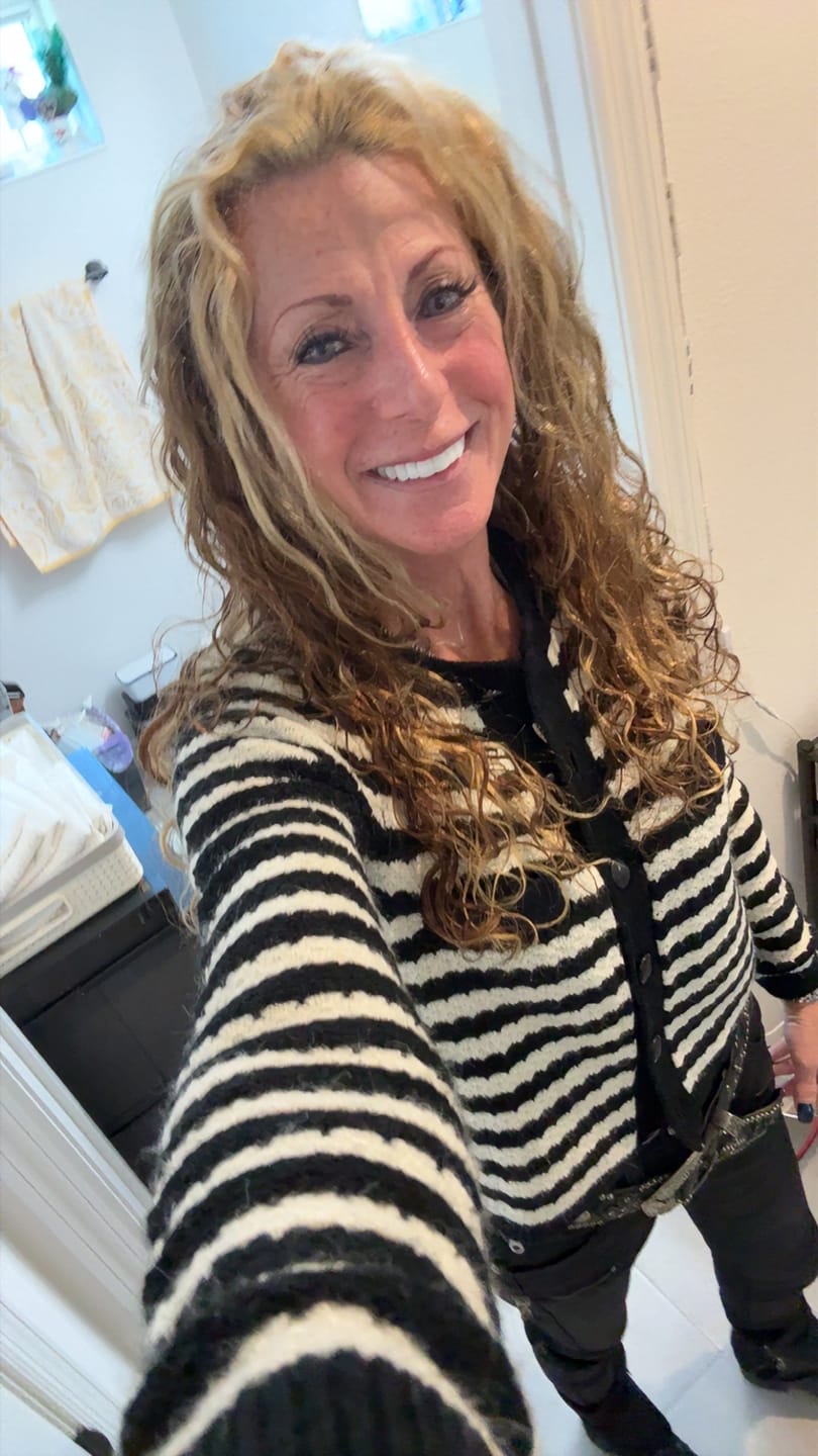 Customer photo review of Hyaluronic Serum Sealer