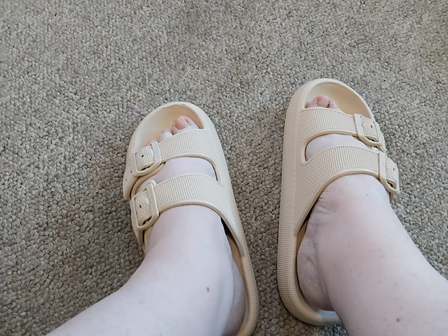 Customer photo review of The Snuggi Sandals