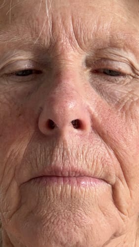 Close-up of reviewer's face showing wrinkled, sun-damaged skin before using Sea Cucumber Collagen Anti-Ageing Cream.