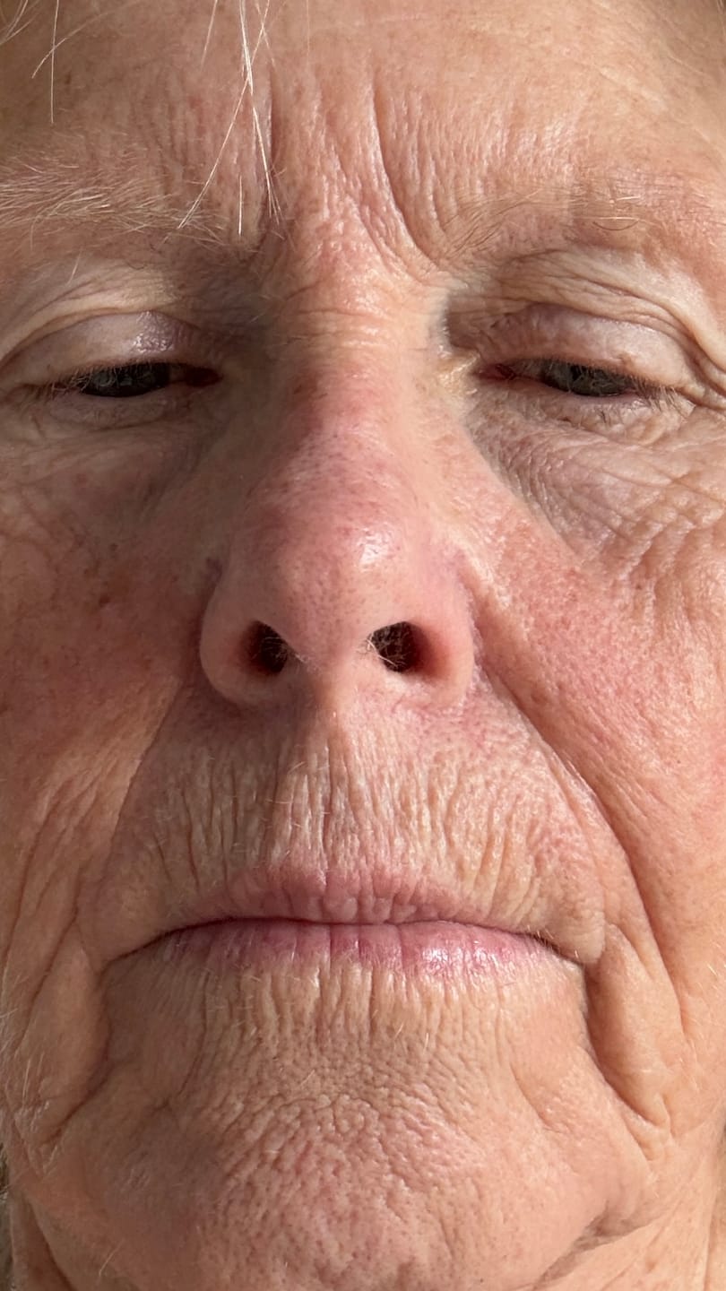 Customer photo review of Sea Cucumber Collagen Anti-Ageing Cream