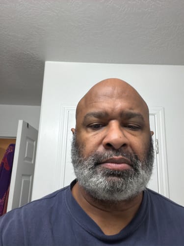 Customer photo review of Beard Care Kit