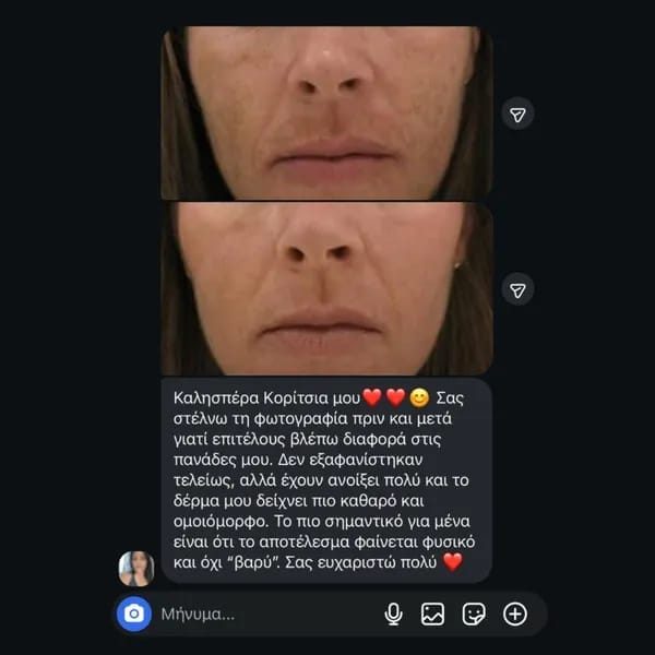 Customer photo review of Labbok Skin Lightening Cream, 30ml