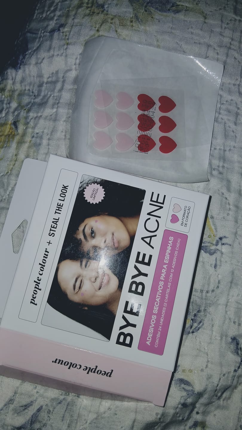 Customer photo review of Adesivos Secativos para Espinhas - Bye Bye Acne