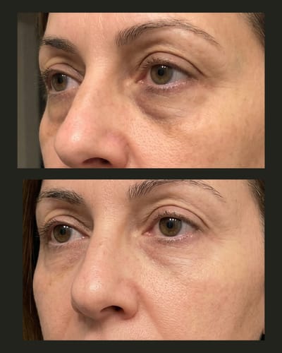 Customer photo review of Labbok Eye Cream dark circles puffiness, 20ml