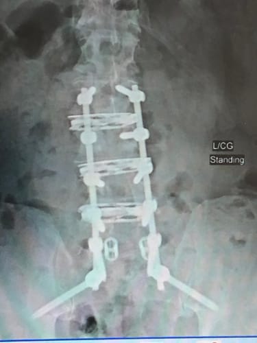 Customer photo review of Rider's Back Support