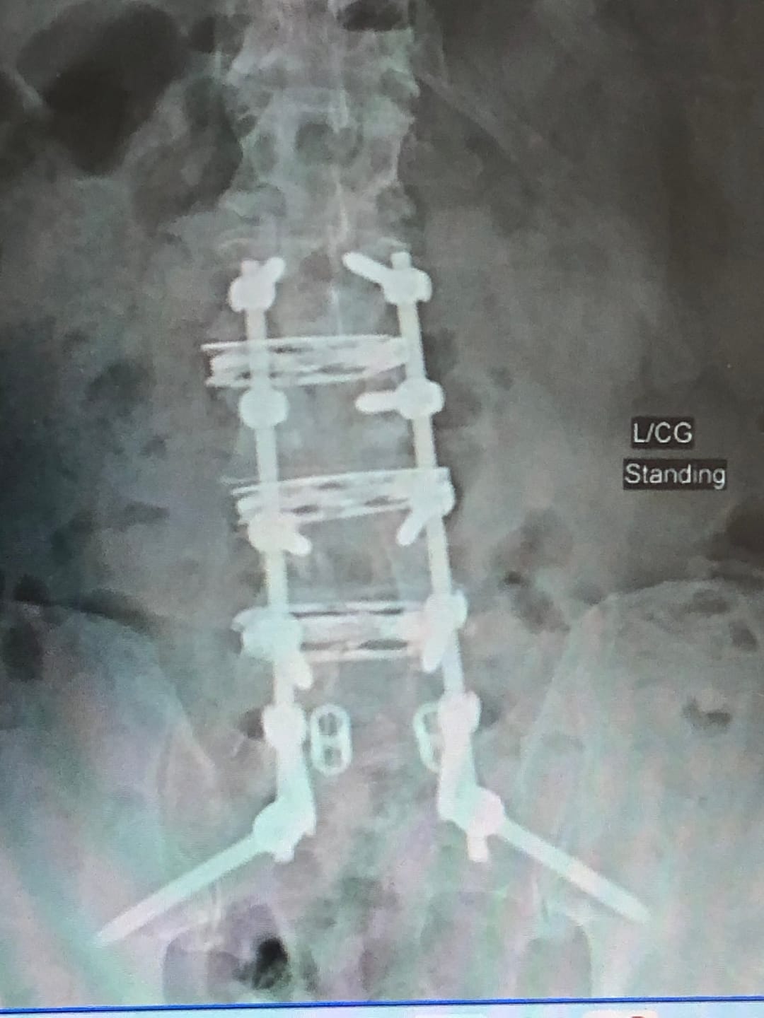 Customer photo review of Rider's Back Support