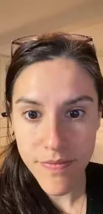 Customer photo review of Korean Hyaluronic PDRN Orb Serum