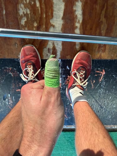 Customer photo review of Thumb Tape