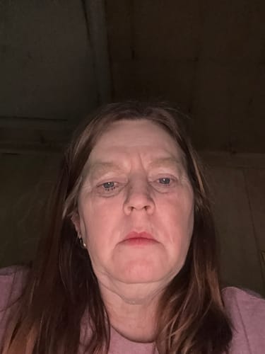 Customer photo review of Transform Wrinkles, Fine Lines, And Tired Creases Naturally