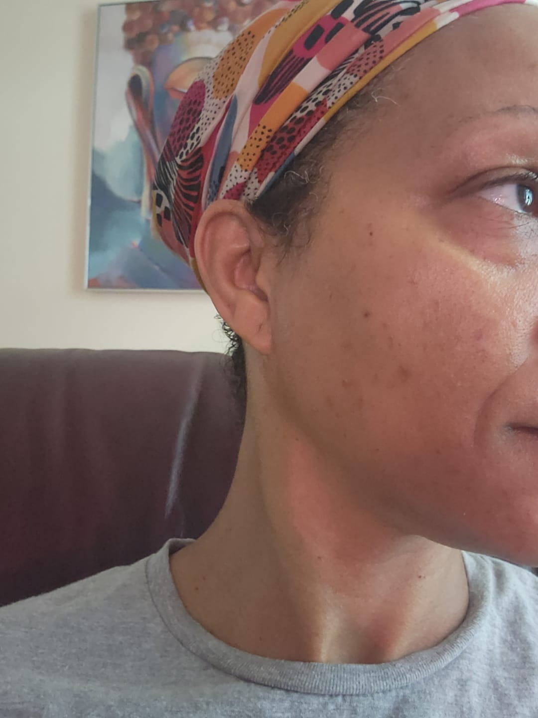Customer photo review of Melanin Skin Bundle