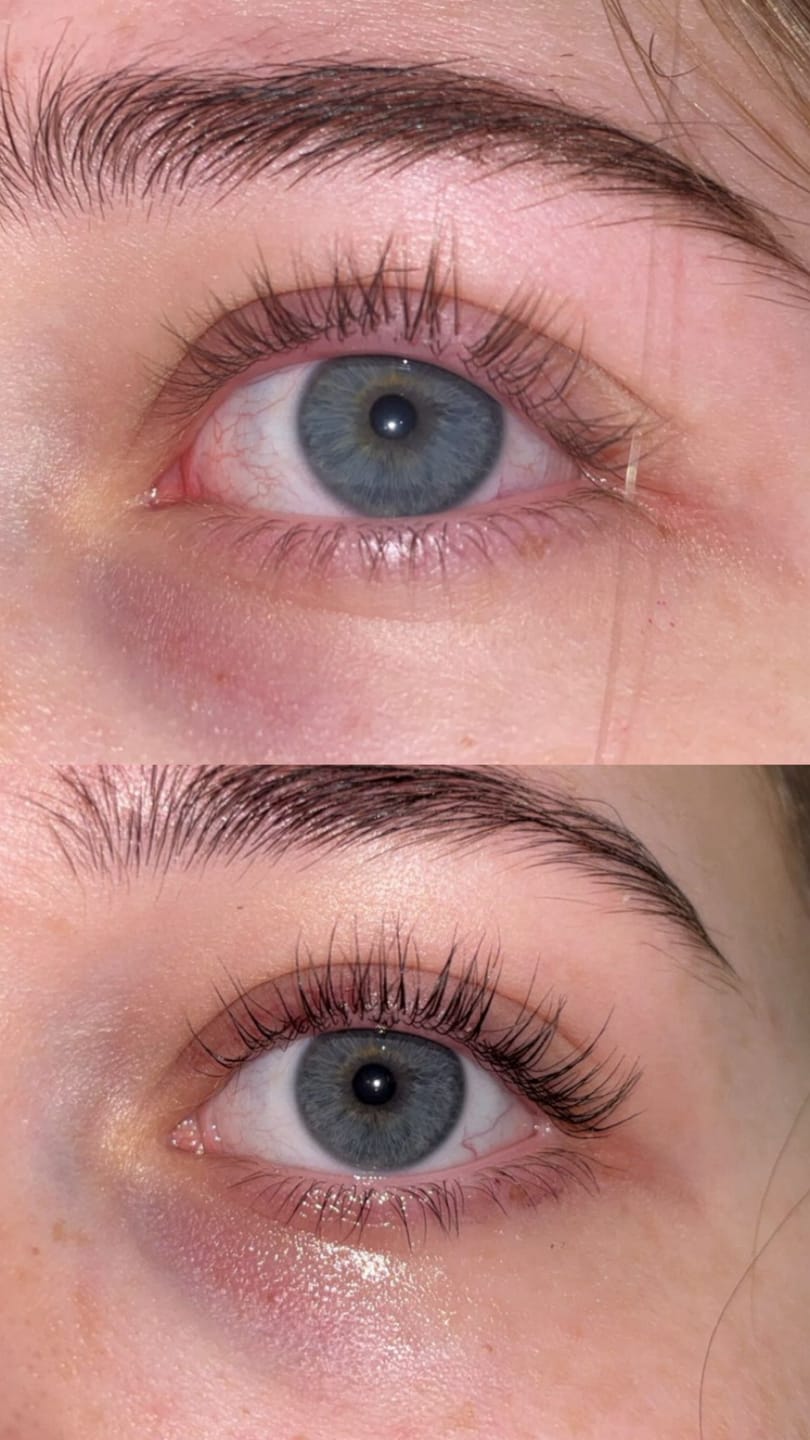Customer photo review of Lash Growth Serum