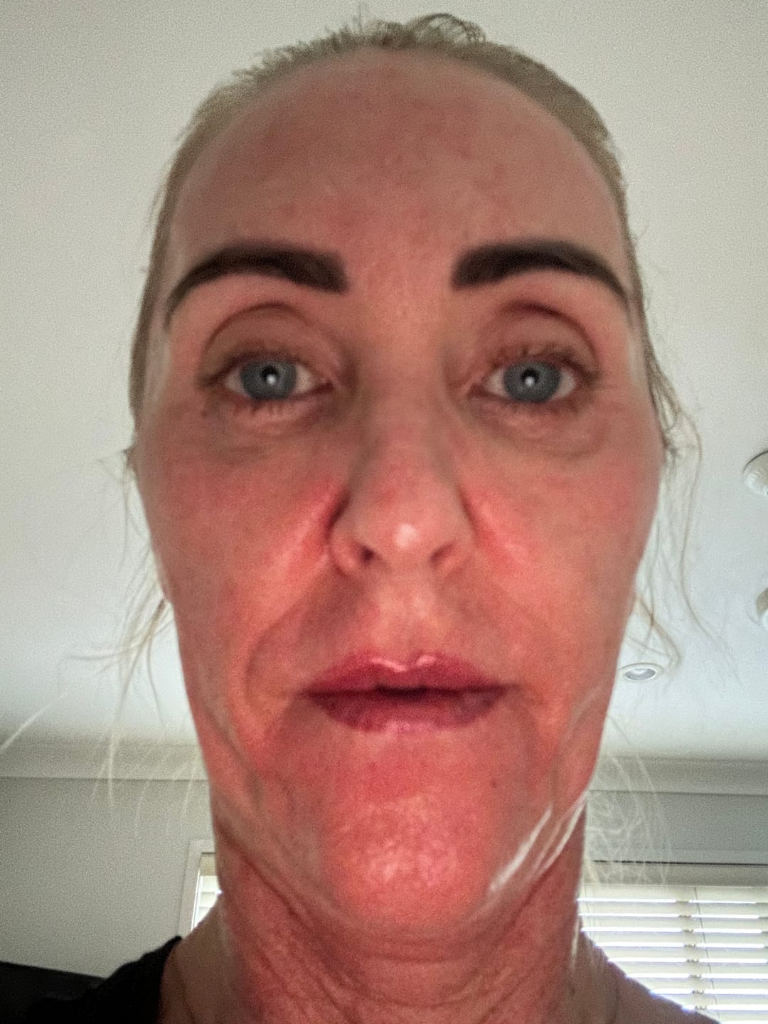 Customer photo review of Glov Micro Infusion System
