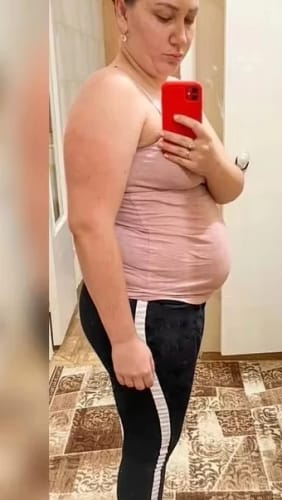 Customer photo review of Fat-Burn Secret Patch - Gewichstverlust OHNE Anstrengung