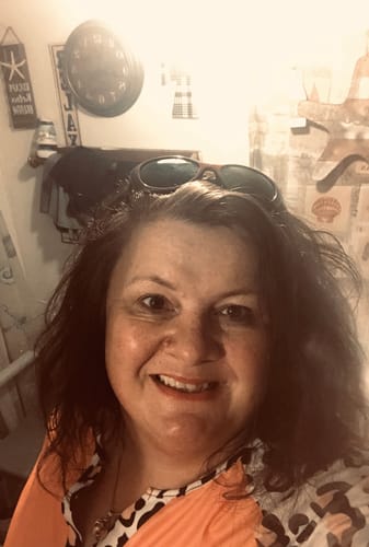 Customer photo review of Transform Wrinkles, Fine Lines, And Tired Creases Naturally