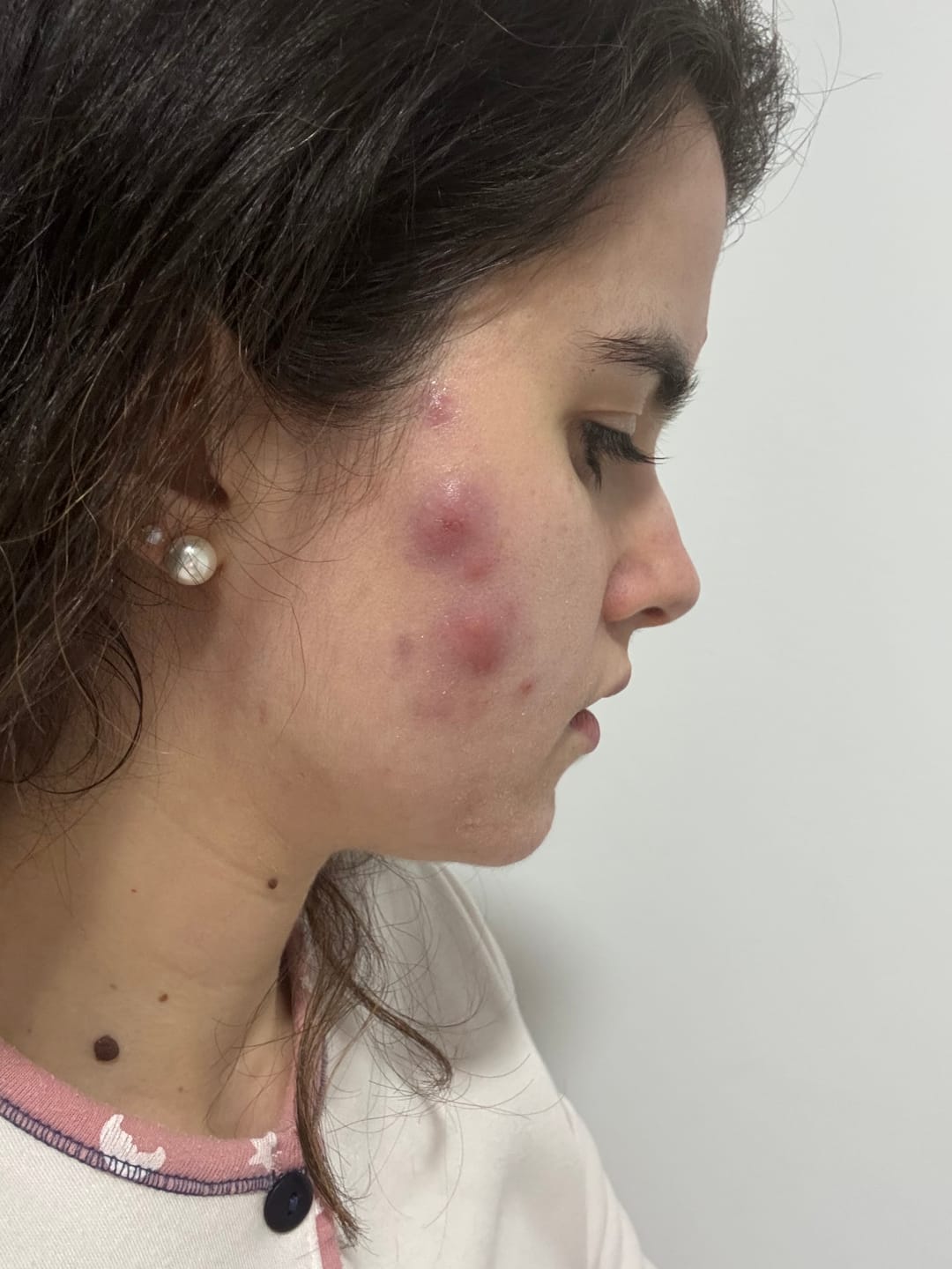 Customer photo review of A CONTROL + CORTIZEN - Equilibrio hormonal desde el cerebro, los ovarios, la piel y el metabolismo.