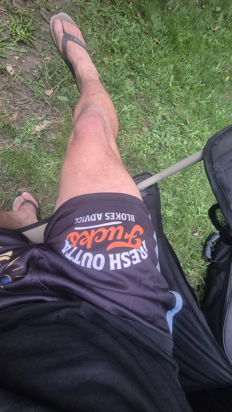 Customer photo review of Aussie As Footy Shorts