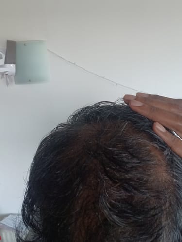 Customer photo review of Seb Natural Calming Serum
