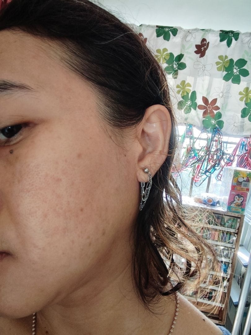 Customer photo review of Ventamin Clear It+: Doctor-Formulated Drink Mix for Acne & Breakout Control
