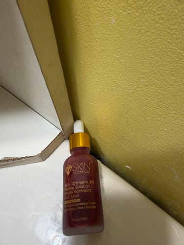 Customer photo review of Acne Treatment Serum