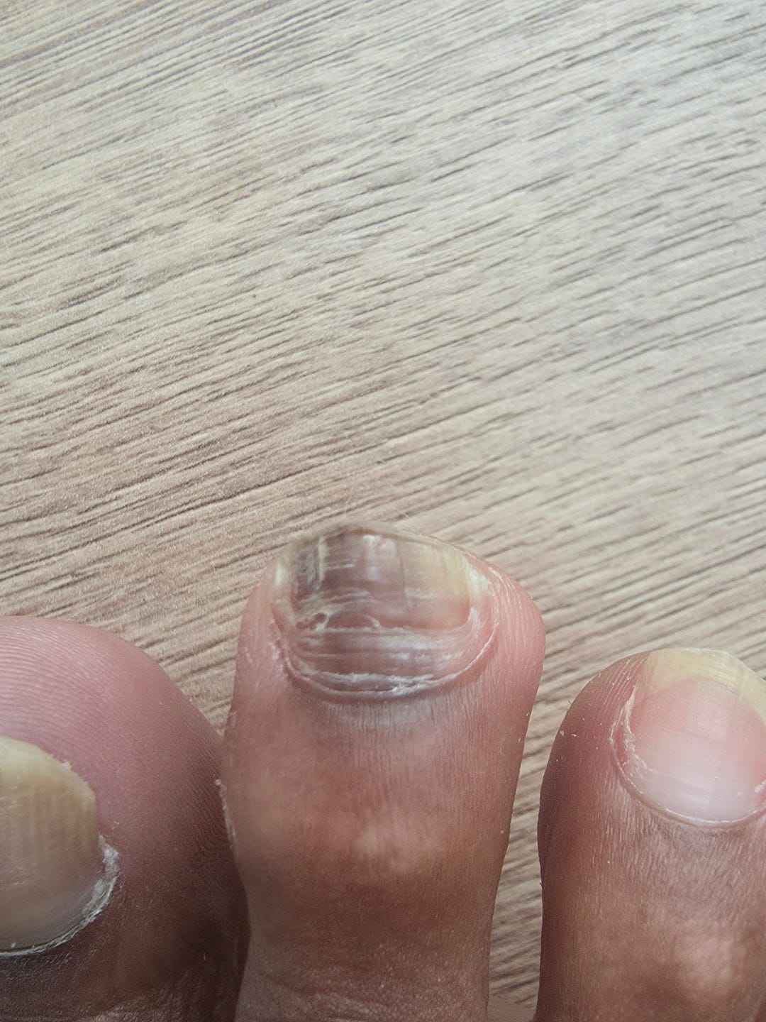 Customer photo review of Fungal Freedom