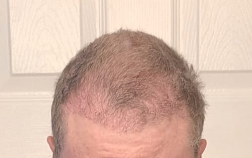 Customer photo review of Thickening Shampoo