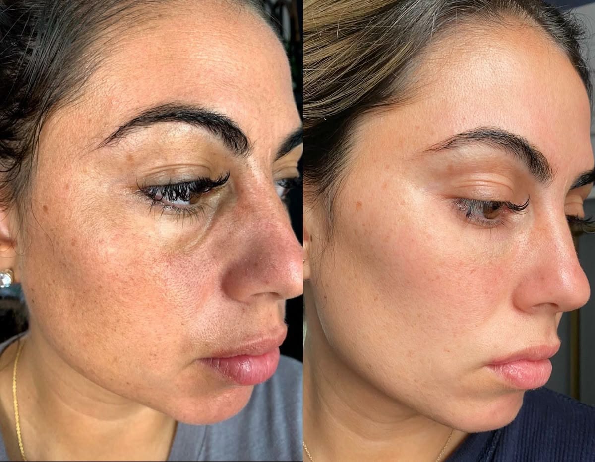 Customer photo review of Lumara Máscara LED