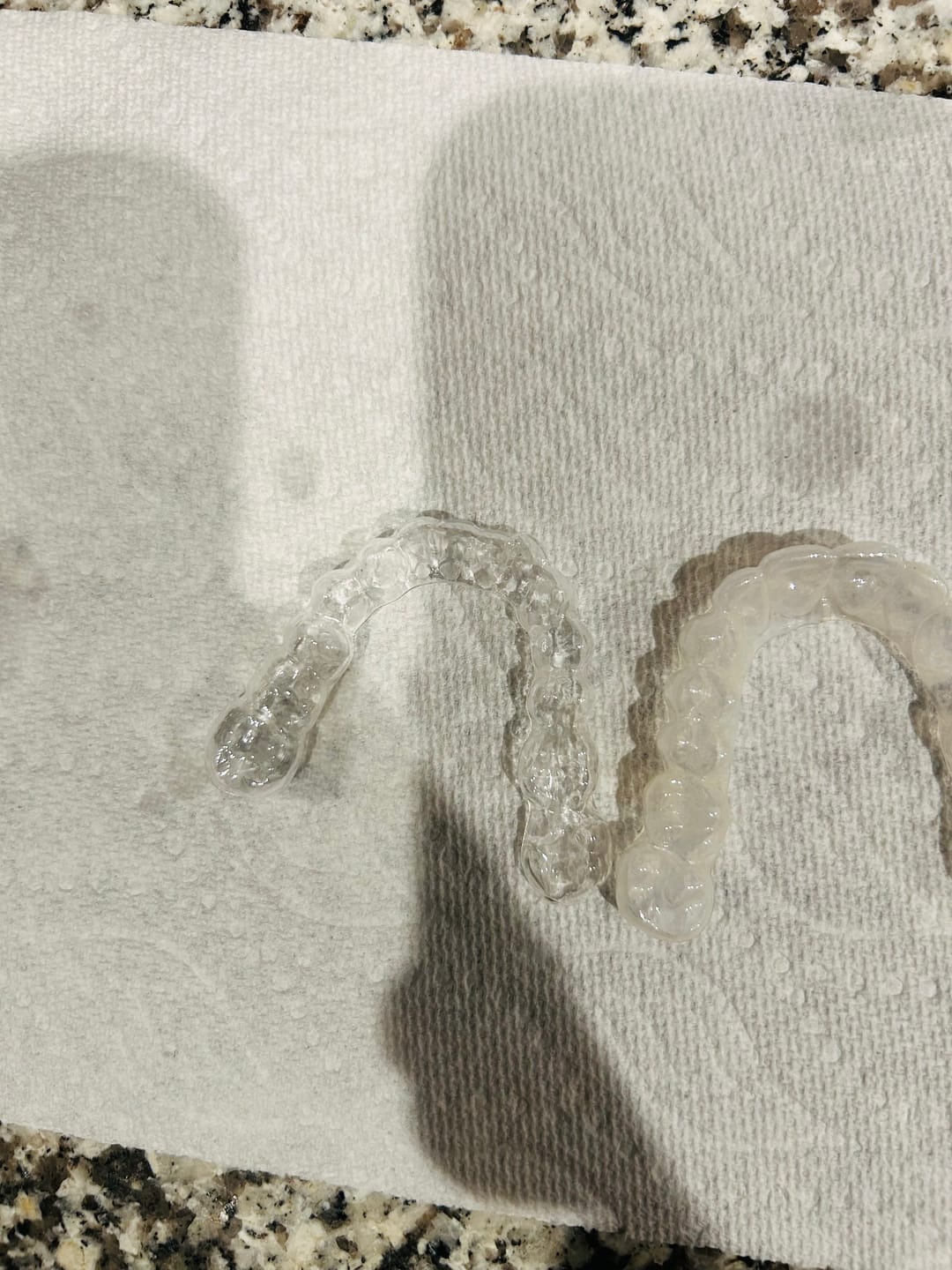 Customer photo review of Zlauna CleanPod ultrahangos tisztító