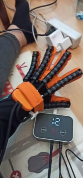 Customer photo review of NeuroHand™ Pro