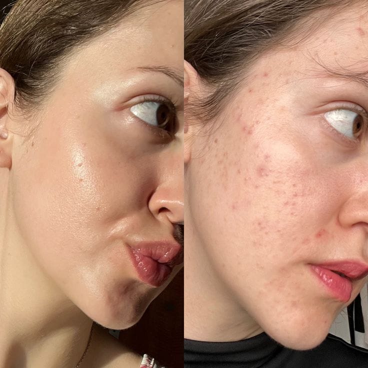 Customer photo review of Lumara Máscara LED