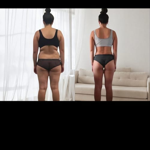 Customer photo review of Anti Cellulite Leggings - Den permanente løsningen på cellulitter