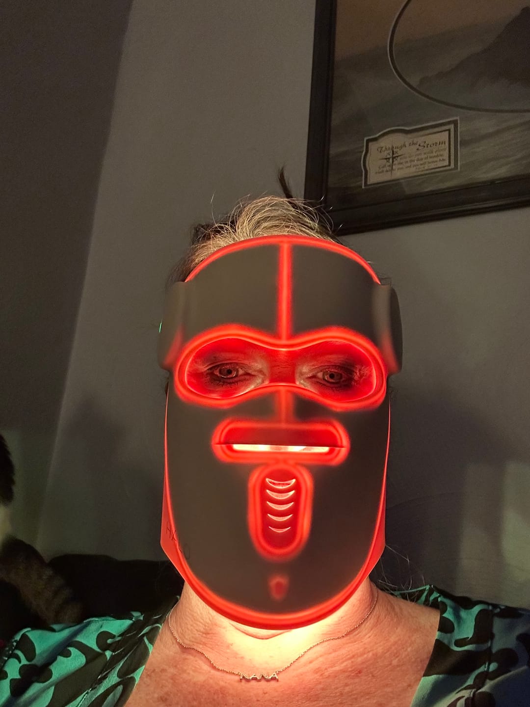 Customer photo review of Hatch Halo™ Dermatologist Grade 3-in-1 Light Therapy Mask