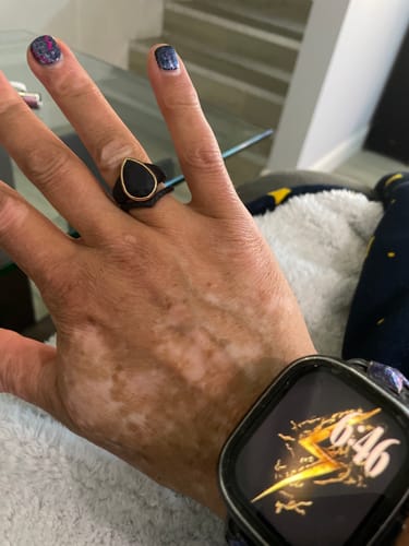 Reviewer's hand wearing the black Oversized Pear Collection silicone ring with its shiny metal frame.