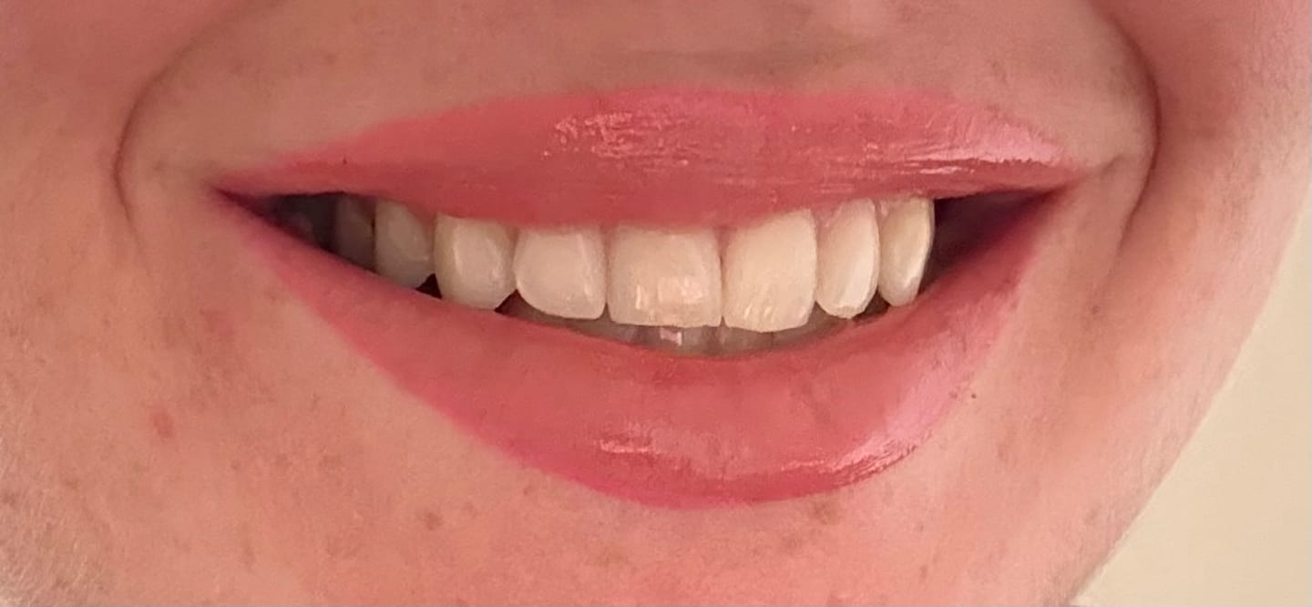 Customer photo review of Soft Silhouette Lip Liner
