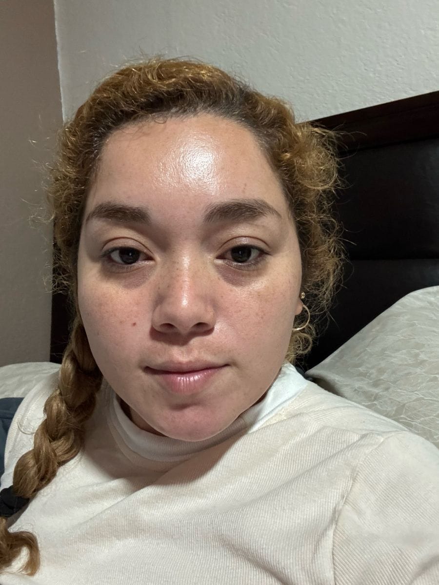 Customer photo review of Lumara Máscara LED