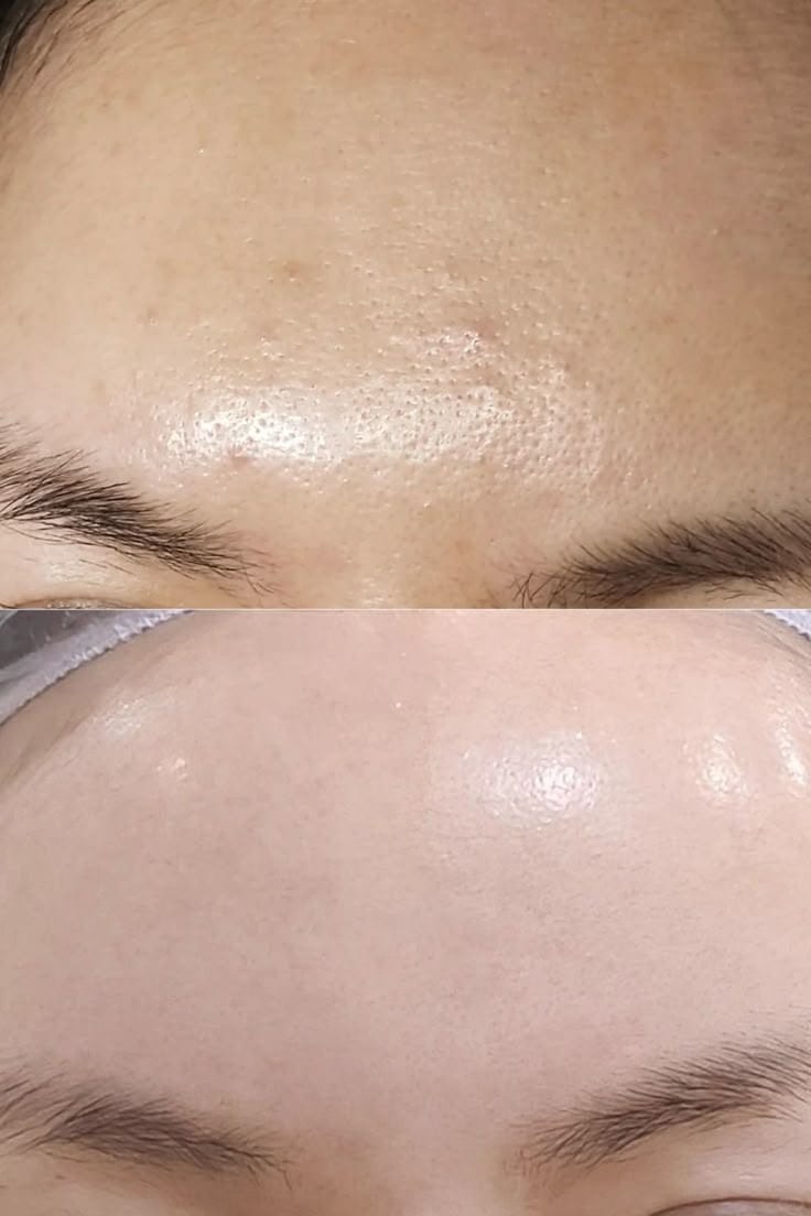 Customer photo review of Maxdif Brightening Moisturizer