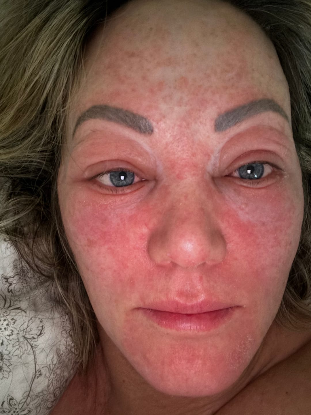 Reseña fotográfica de una clienta sobre el cuidado facial botánico diario de Renate.
