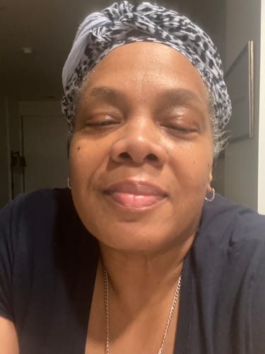 Customer photo review of Transform Wrinkles, Fine Lines, And Tired Creases Naturally