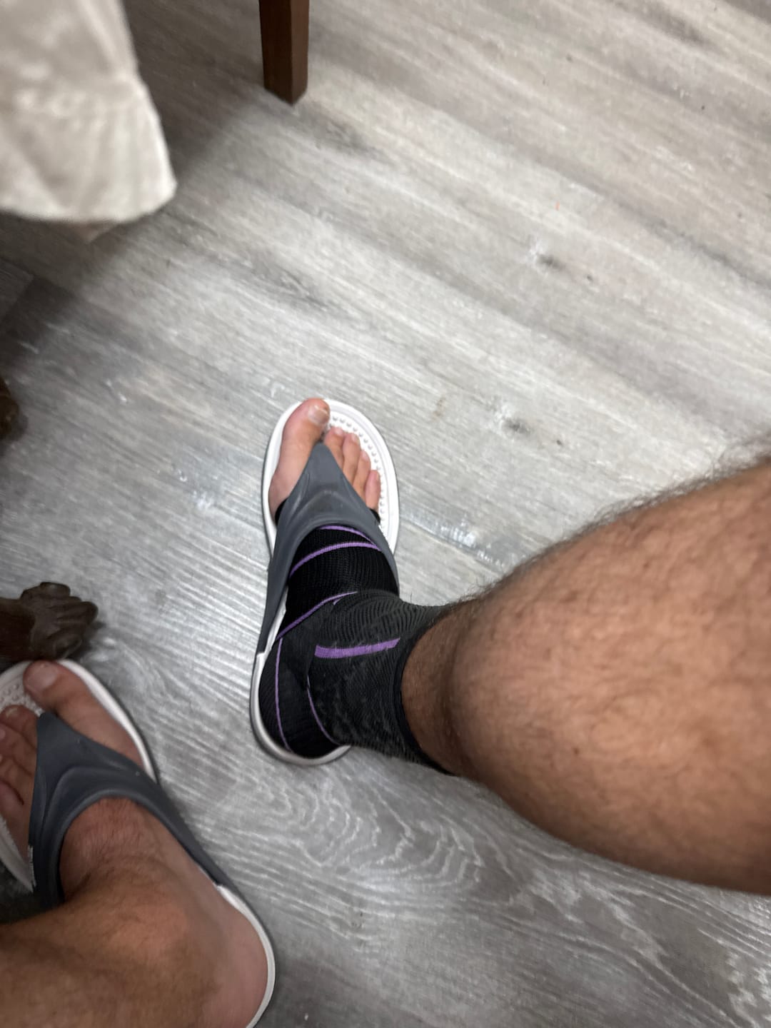 Customer photo review of Tobillera de Compresión AnklePro Marca Wilma