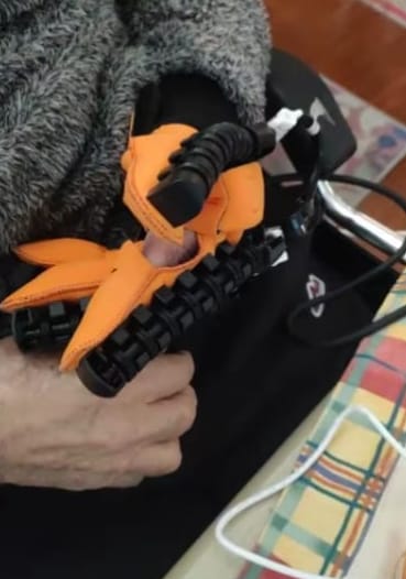 Customer photo review of NeuroHand™ Pro