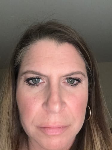 Customer photo review of Transform Wrinkles, Fine Lines, And Tired Creases Naturally