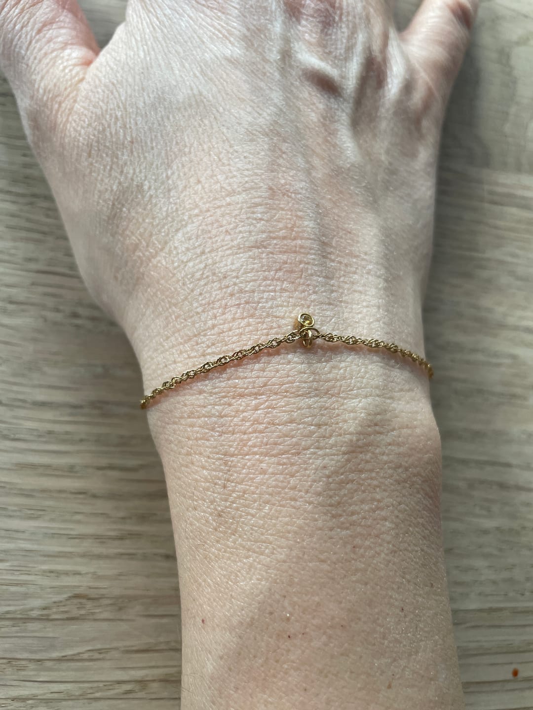Customer photo review of Permanent Armband - dein everbond in München
